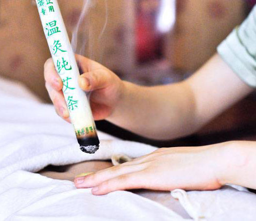 艾灸疗法 让你不再做体寒美女