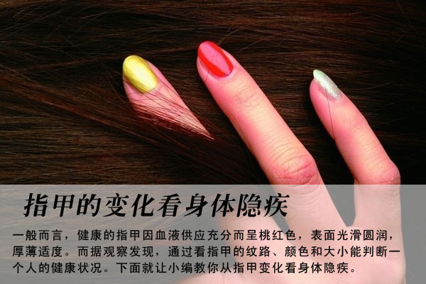 从指甲变化看身体隐藏疾病